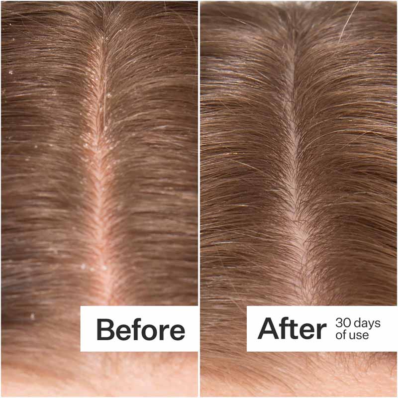 Act+Acre Microbiome Cooling Scalp Serum