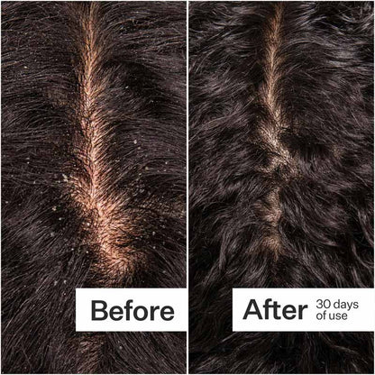 Act+Acre Microbiome Cooling Scalp Serum