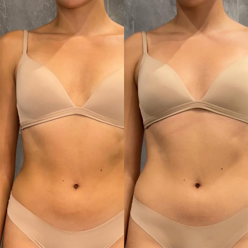 Bare by Vogue Express Tan Removal Gel