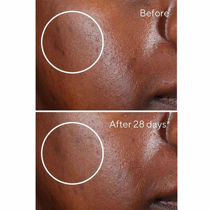 Murad Environmental Shield Rapid Dark Spot Correcting Serum