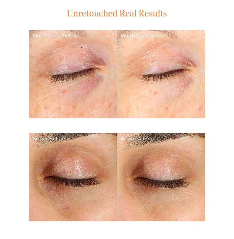 Murad Environmental Shield Vita-C Eyes Dark Circle Corrector