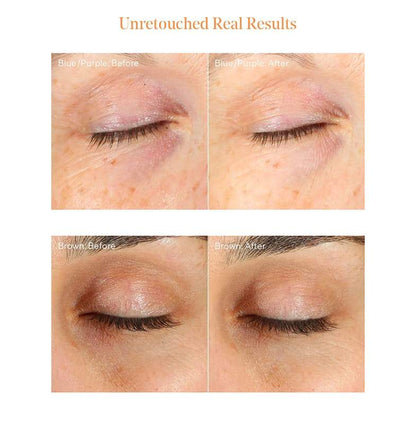 Murad Environmental Shield Vita-C Eyes Dark Circle Corrector