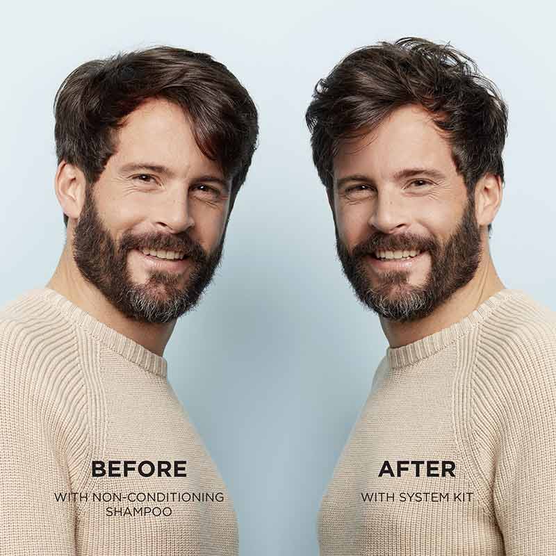 Nioxin System 1 Scalp & Hair Treatment