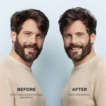 Nioxin System 1 Scalp & Hair Treatment